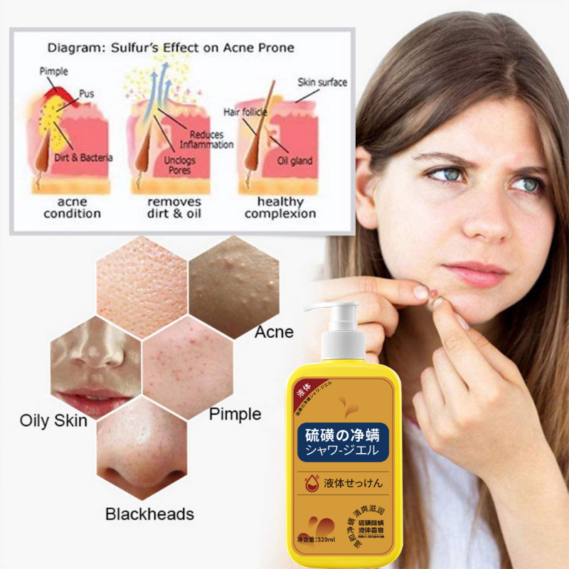 Sulfur Liquid Mite Removal Soap Shower Gel Deep Cleansing Whole Body Acne Body Wash