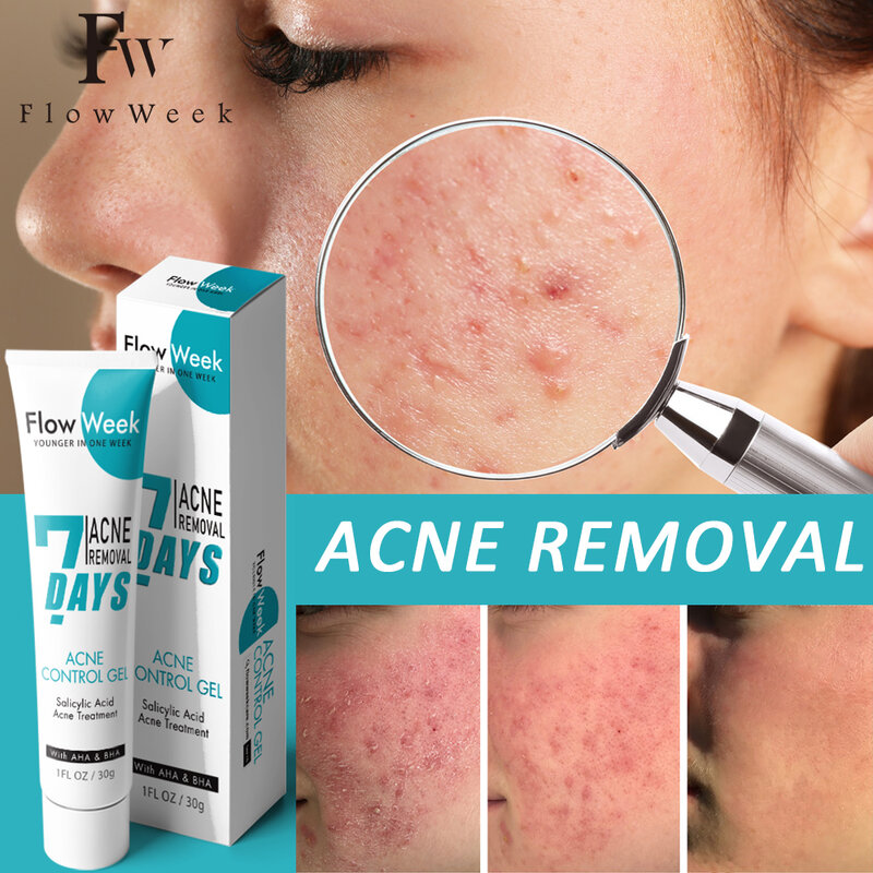 Flow week acido salicilico trattamento dell'acne Gel Tea Tree brufolo rimozione macchie crema viso crema sbiancante Anti-Acne cura della pelle