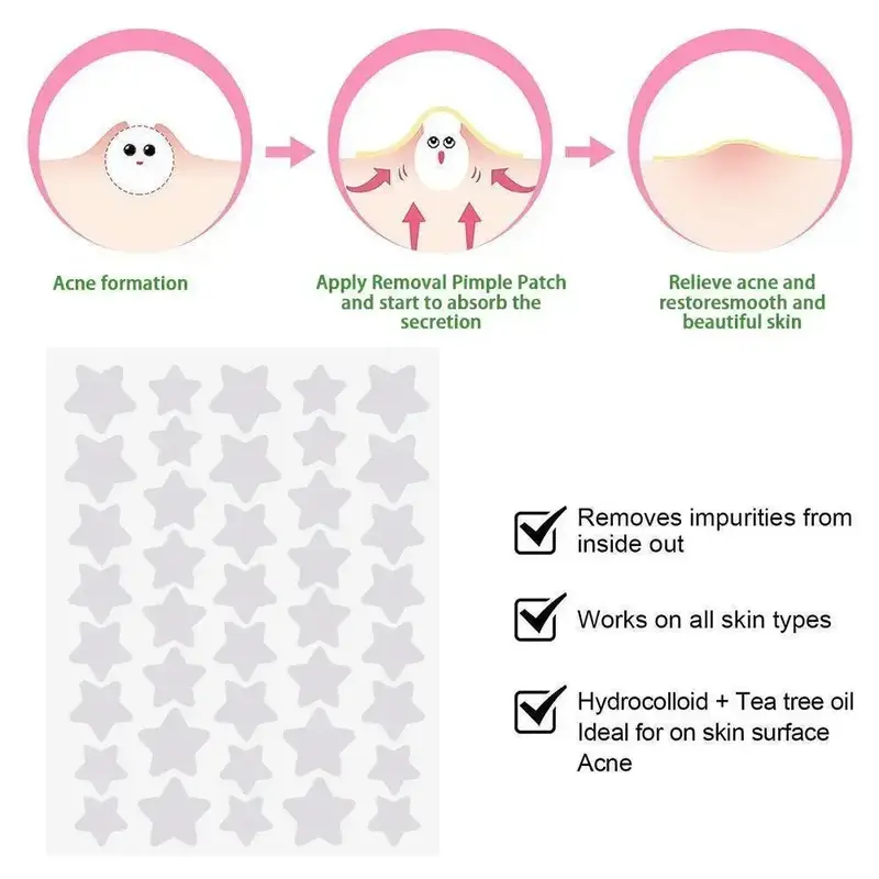 40pcs Star Shaped Acne Pimple Patch Invisible Concealer Waterproof Blemish Spot Pimple Treatment Face Beauty Skin Care