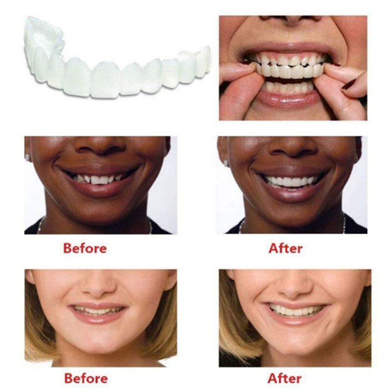 1-5Set Upper Lower Temporary Fit Fake Teeth Cosmetic Denture Smile Veneers False Teeth Brace Cover Upper False Tooth Cover Snap