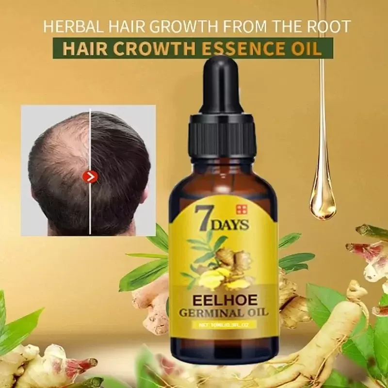 Быстрое средство для роста волос, имбирное масло для волос, лечение против выпадения волос, мужская и женская Сыворотка для лечения кожи головы, продукты для красоты и здоровья 2024