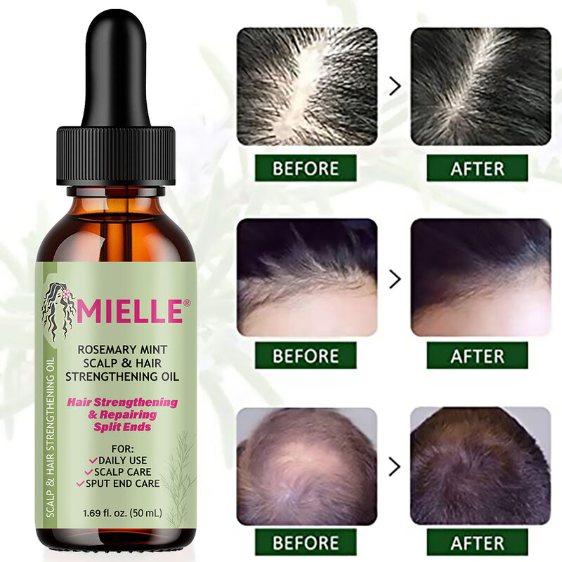 Óleo essencial para o crescimento do cabelo, tratamento nutritivo para cabelos secos, Mousse Organics e Split Termina cabelo, óleo nutritivo, alecrim hortelã