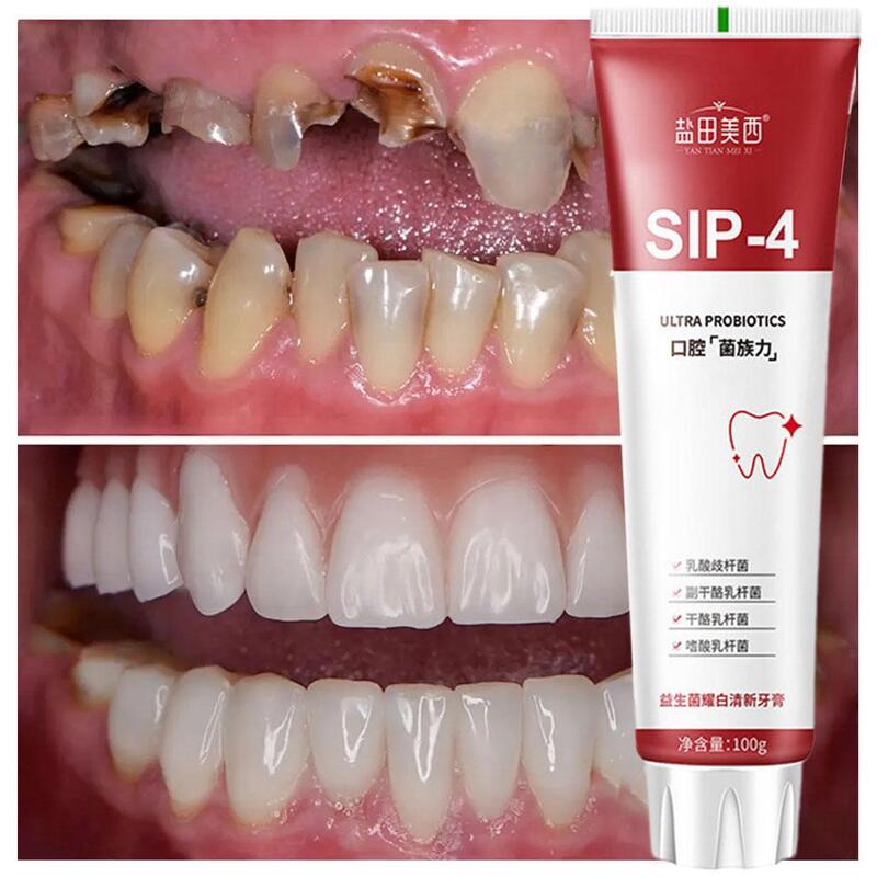 Creme dental probiótico para remover o mau hálito, clareamento e mancha, Fresh Whiten Teeth, SP-4, Sip-4, 100g, 1 Pc, 2 Pcs, 3 Pcs, 5Pcs