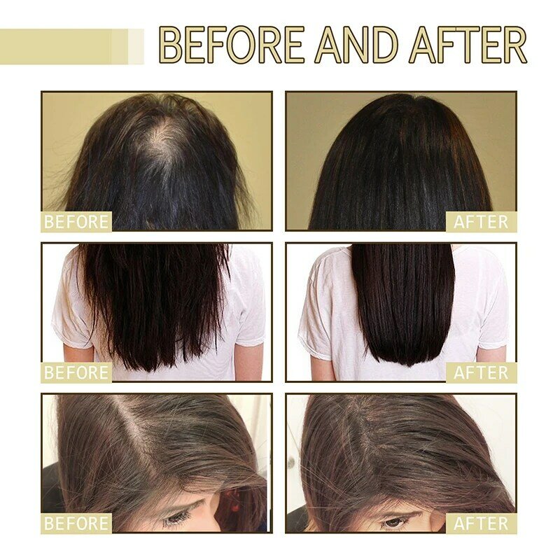 Натуральное масло для роста волос эффективное против выпадения волос питательное эфирное масло для густого восстановления поврежденных волос увлажняющее гладкое масло