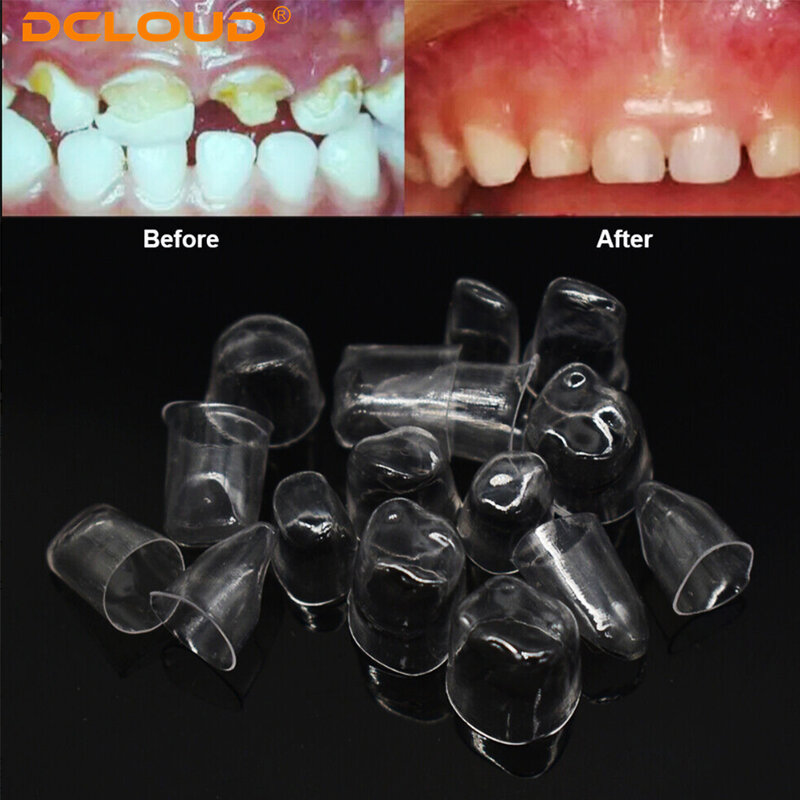 NUEVO 64Pcs/Box Resina Dental Transparente Precorona Anterior Posterior Decidua Preformada Molar Corona Dental Material 1.910