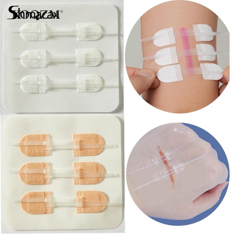 2Pcs/3pcs Band-Aid Zipper Tie Wound Closure Patch Hemostatic Patch Wound Fast Suture Zipper Band-Aid Outdoor Portable