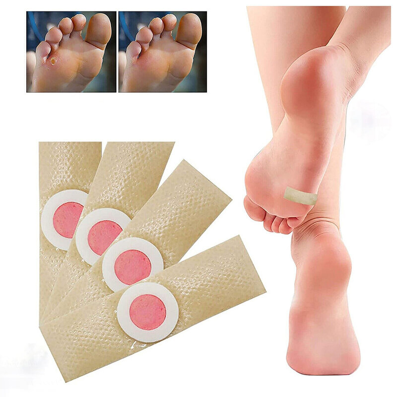 20pcs Corn Patch Natural Corn Removal Plaster For Foot Care Plantar Warts Removal Calluses On Hands And Feet