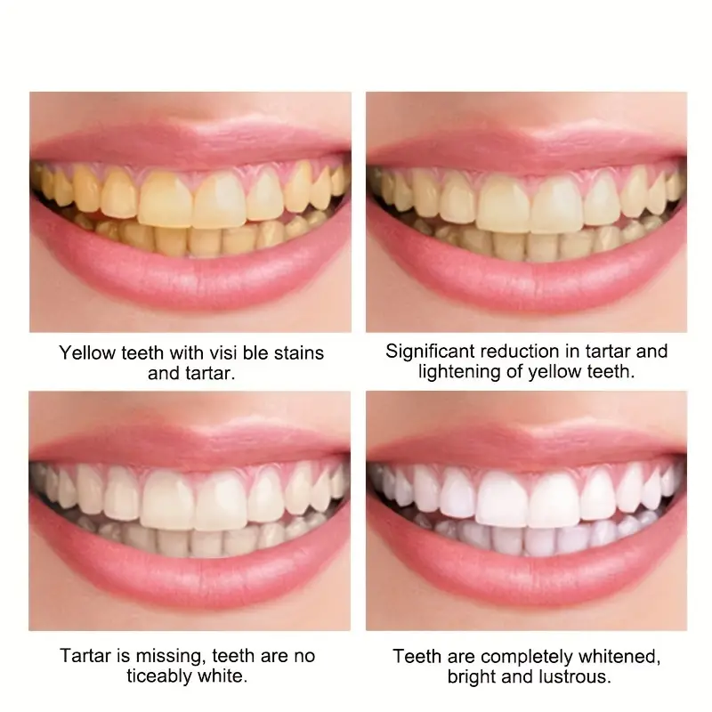 60 мл мусс для отбеливания зубов Глубокая очистка сигаретные пятна ремонт яркий нейтрализует желтые оттенки зубной налет свежий запах