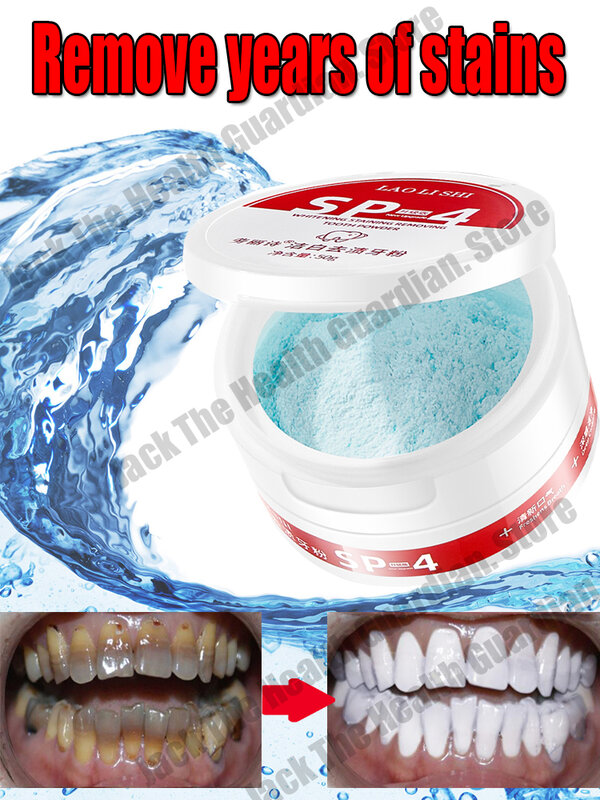 Remover Dental Calculus Whitening Teeth Mouth Odor Removal Bad Breath Preventing Periodontitis