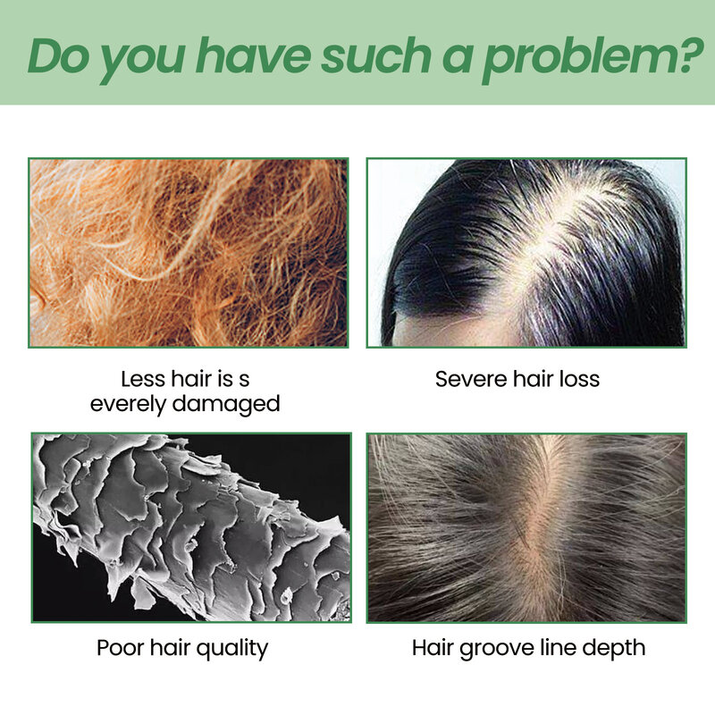 Spray de crecimiento del cabello de arroz sin aclarado, Anti pérdida de cabello, reparación de raíces densas del cabello dañado, nutritivo, hidratante, tratamiento del cuero cabelludo