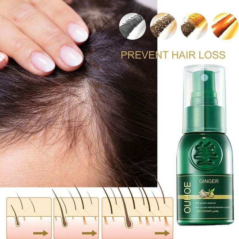 Nuovi prodotti Spray allo zenzero siero naturale anticaduta per prevenire il trattamento della calvizie crescita rapida nutrire i capelli danneggiati