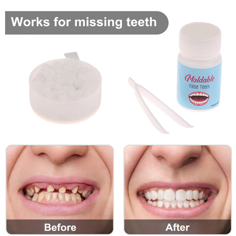 一時的な歯の修理キット,偽の歯の接着剤,固体の接着剤,歯のホワイトニング,美容ツール,10g, 15g, 25g