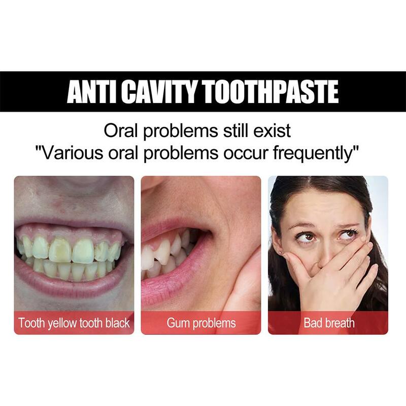 معجون أسنان مبيض ، رائحة الفم الكريهة الطازجة ، إزالة البلاك ، تخفيف وجع الأسنان ، تقليل الاصفرار ، العناية بلثة الأسنان ، الأسنان الفموية ، D5J1