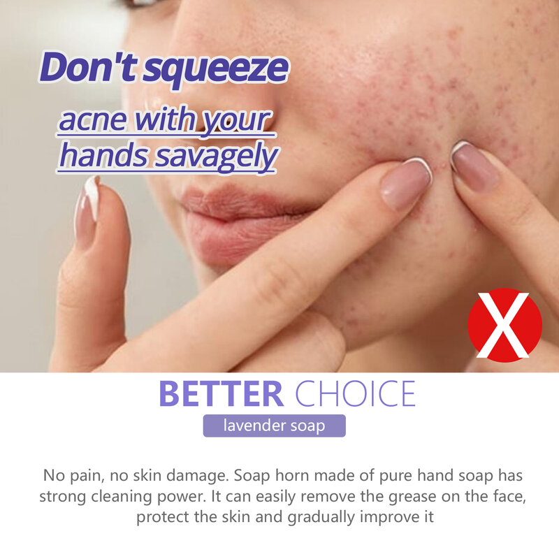 Sabonete cuidado remover espinhas manchas escuras clareamento 100g sabão de lavanda para o controle de óleo da pele anti-acne anti-pruritic lavagem ácaros