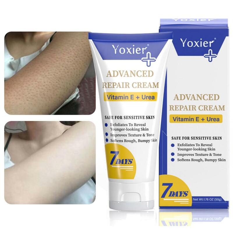 1/2/3/5X  Moisturizing BodyCream Treatment Keratosis Pilaris Improves E Bumpy Rough Whitening Texture Skin Softens Vitamin Tone