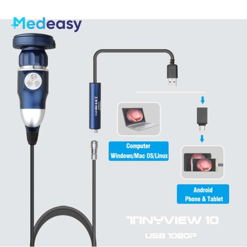كاميرا التنظير الطبي المحمولة ، جراحة الأنف والحنجرة ، USB ، Full HD ، 1080P ، HDMI ، مصدر ضوء مجاني