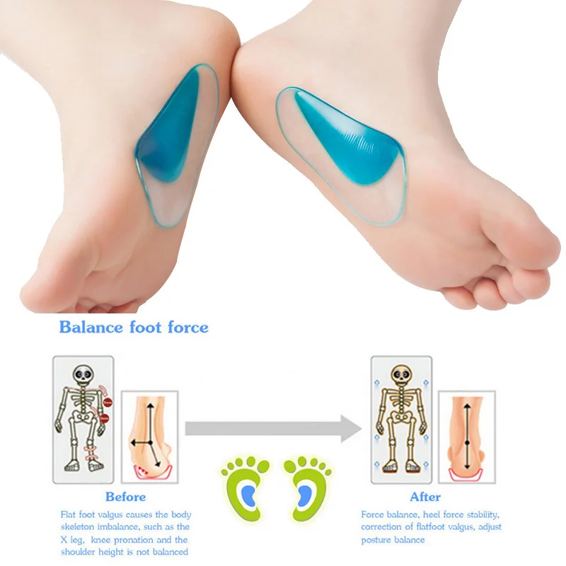 Wkładka ortopedyczna profesjonalna wkładka podpierająca sklepienie stopy płaskostopie korektor płaskostopia buta wkładka do poduszki silikonowa żelowa wkładka ortopedyczna