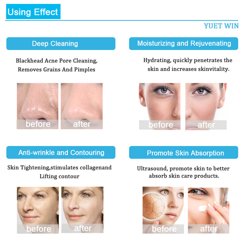 Hydro DermDelhi Hydrogen Oxygen Facial Machine, Deep Skin Cleansing, Lifting Skin Scrubber, Aqua Facial Care Formers, 7 en 1
