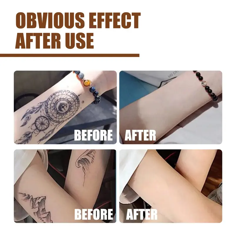 Quick Tattoo Removal Serum Permanent Tattoo Remover Liquid Tattoo Remover Water for Permanent and Painless Removal of Pigment