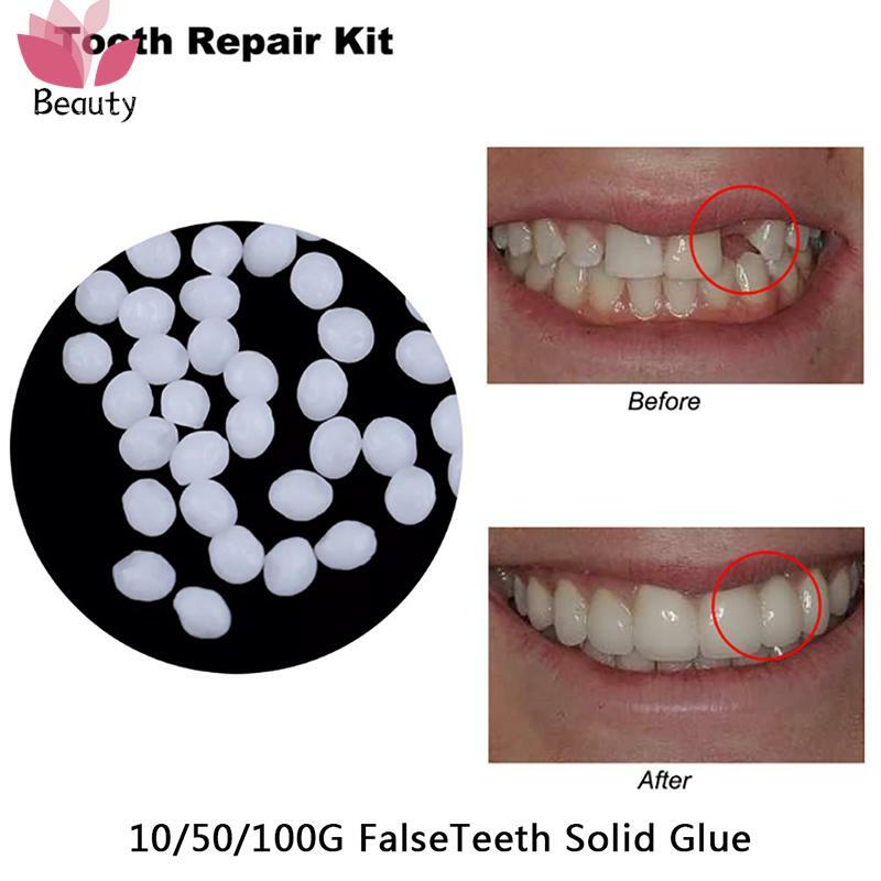 Kit di riparazione dentale temporaneo da 30ML denti e spazi vuoti FalseTeeth colla solida adesivo per protesi sbiancante per denti strumento di bellezza per i denti