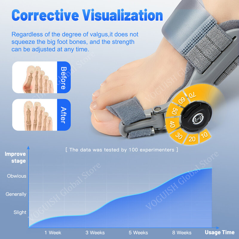 Bunion Spalk Corrector Grote Teen Stijltang Unisex Voet Hallux Valgus Beugels Orthopedische Benodigdheden Pedicure Voetverzorging Pijnverlichting