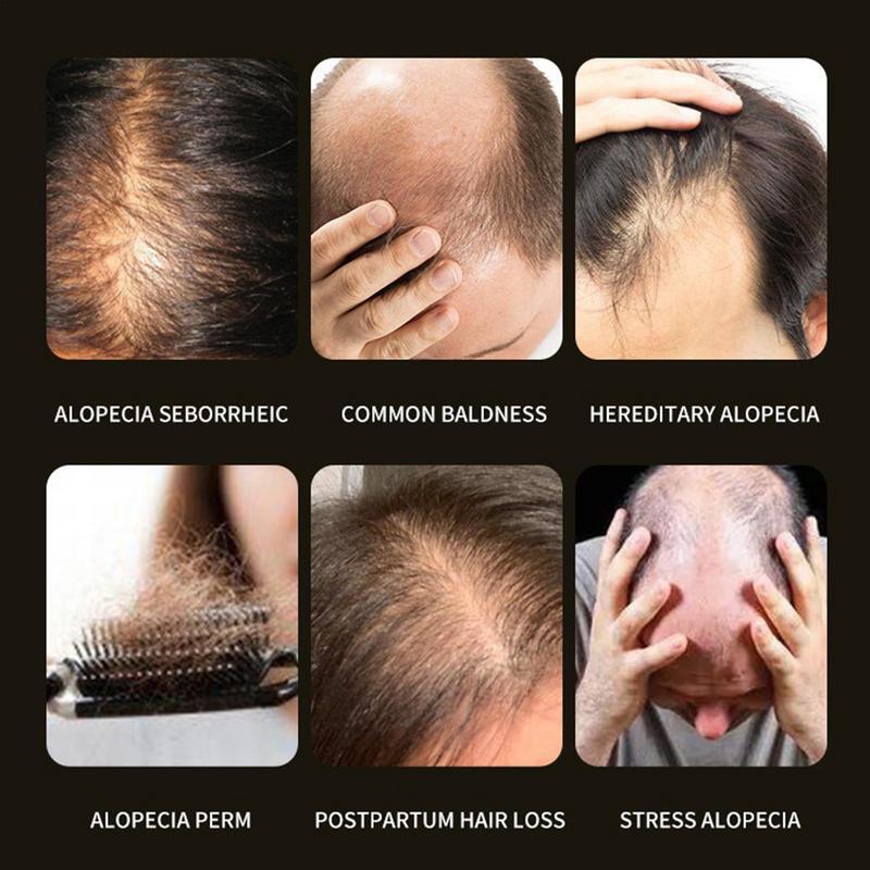 30 مللي نمو الشعر المغذيات غير دهني جوهر الشعر الجمال اكسسوارات ل المجعد السيطرة تعزيز و مغذية الشعر