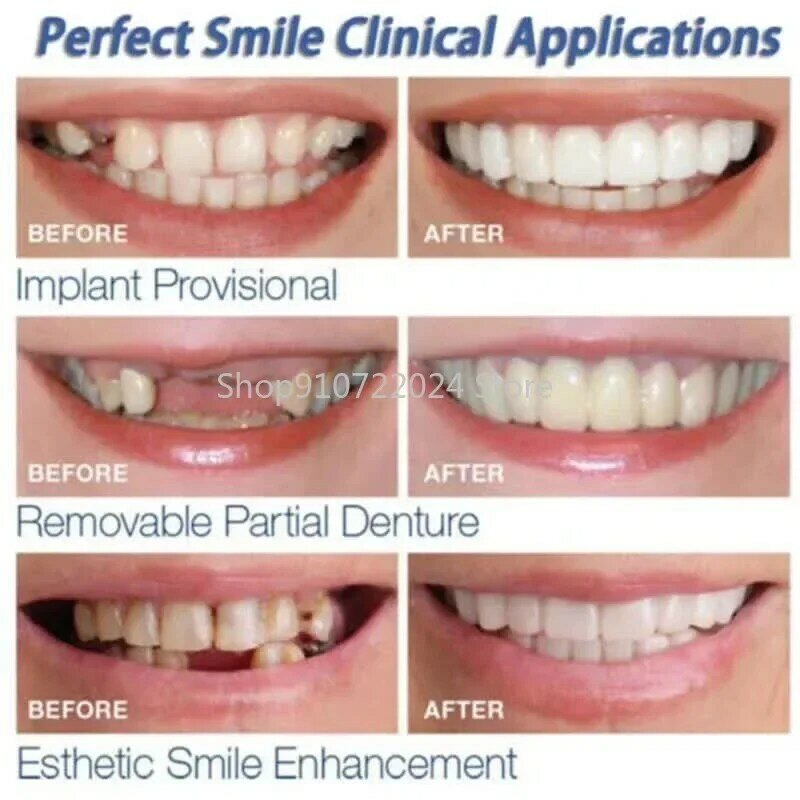 Silicone dentes branqueamento capa, dentes chaves, superior e inferior simulação dentadura, caixa incluída, sorriso perfeito, 2pcs por conjunto