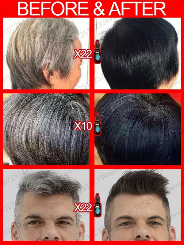 جوهر معالجة الشعر الأبيض ، وإزالة الشعر الأبيض بسرعة في الشعر الأسود ، ويزيل اللون الطبيعي والشعر الرمادي