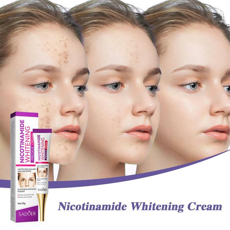 Nicotinamida Whitening Freckles Creme, Remover Melasma, Mancha Escura, Marcas de Acne, Clareamento da Pele, Face Skin Care, 20g, 1, 2, 3, 5Pcs