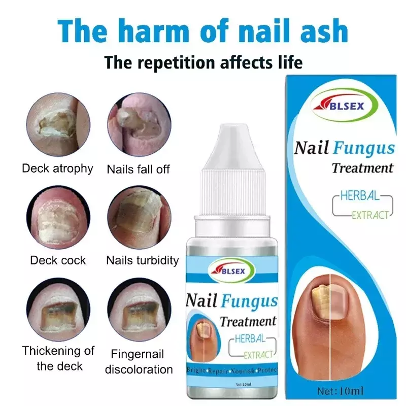 Solución de reparación de uñas, tratamiento de hongos para uñas de los pies, reparación de onicomicosis, paroniquia, antiinfección, nuevo