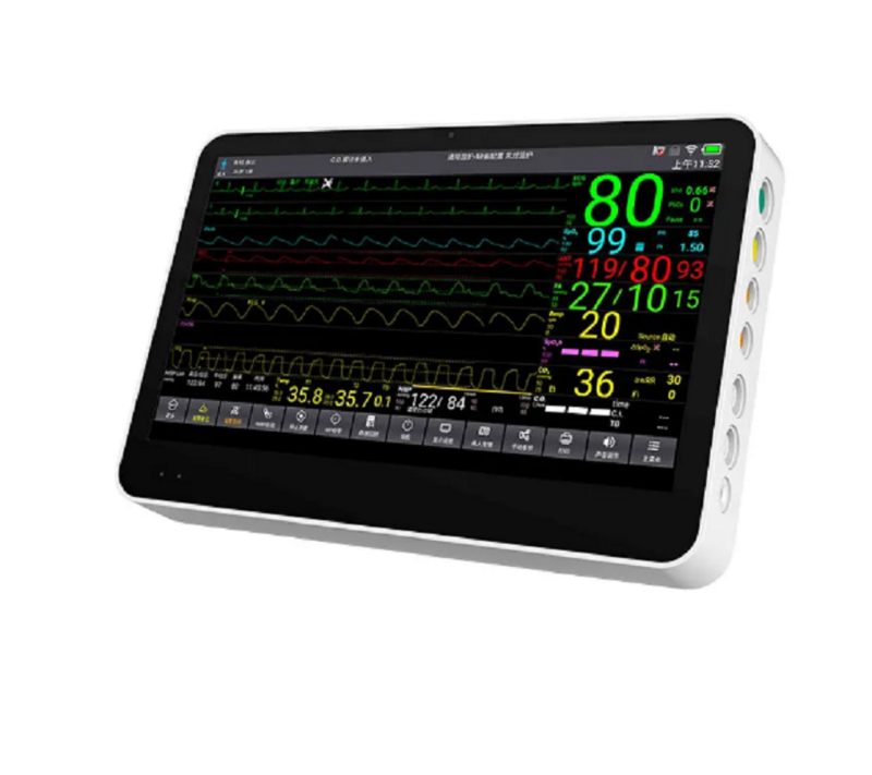 CONTEC-Monitor de Sinais Vitais, Monitor de Pacientes ICU, Touch Color LCD, 6 Parâmetros, 14 ", CMS8500