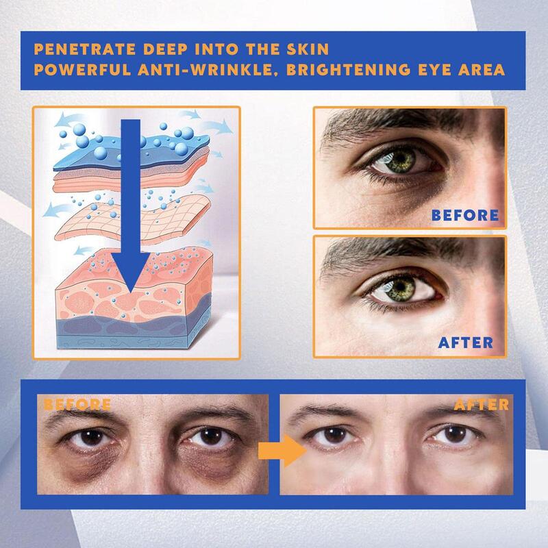 Krem pod oczy dla mężczyzn Anti-Aging ciemne kółko pod okiem leczenie oczu przeciw ciemne koła człowiek kojący krem pod oczy przeciwzmarszczkowe oczy