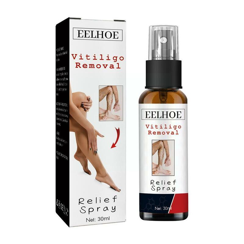 30Ml Reliëfspray Huid Hydraterende Vitiligo Net Spray Gezicht Vervaagt Herstel Lichaamsvlekken Spot Vitiligo Witte Reparatie Huid R2u4