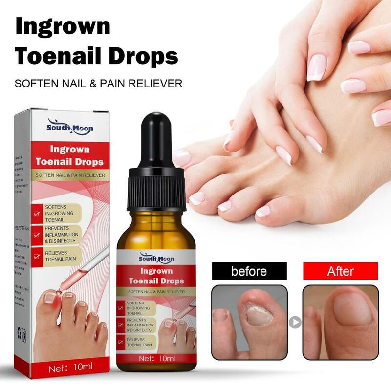 LOT Ingrown Toenail Treatment Liquid Effective Serum Nail Correction Recover Oil Pain Reliever Nail Softener Repair Foot Nail