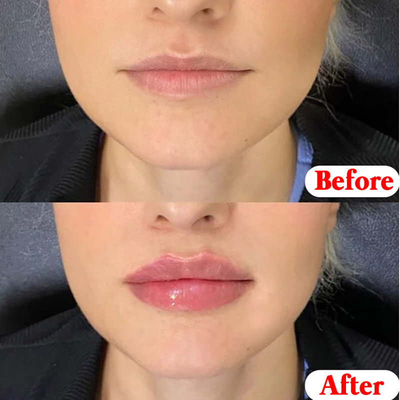 Bahan Pelembap Keamanan Bibir Dasar Pelembap Tanaman Alami Anti-retak Lipstik Perawatan Bibir Meringankan Garis Bibir Grosir
