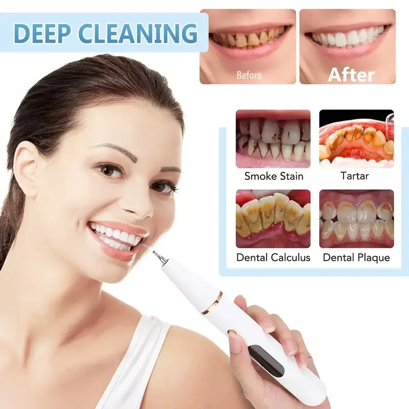 منظف أسنان كهربائي بالموجات فوق الصوتية ، مزيل القلح والجير ، إزالة البلاك ، تلميع الأسنان المنزلي ، إزالة البقع