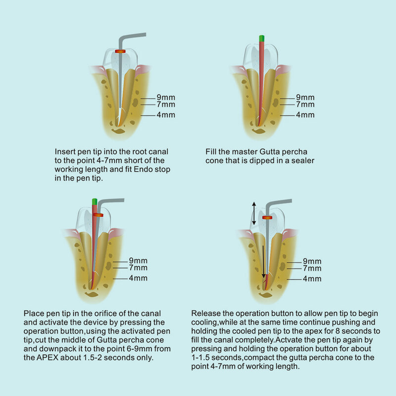 Стоматологическая Беспроводная система обтурации Гутта перча с подогревом и 2 наконечниками