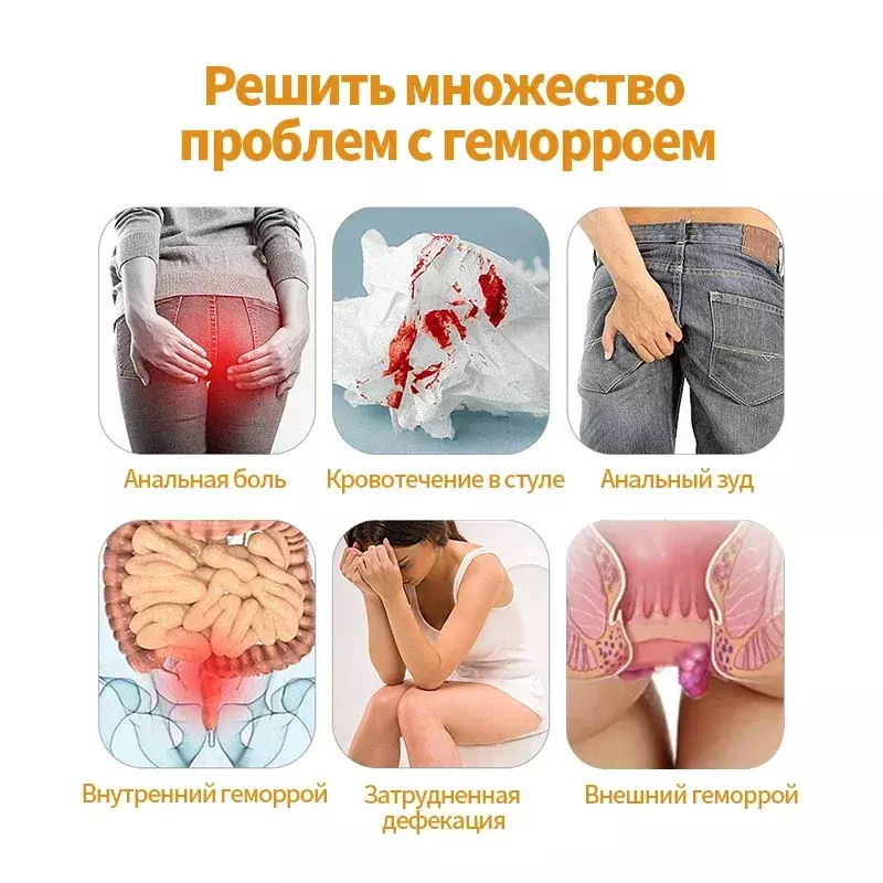 Creme De Tratamento De Hemorroidas, Alívio Da Dor, Remoção De Fissura Anal, Intemal, Medicina Externa De Hemorroidas, Língua Russa