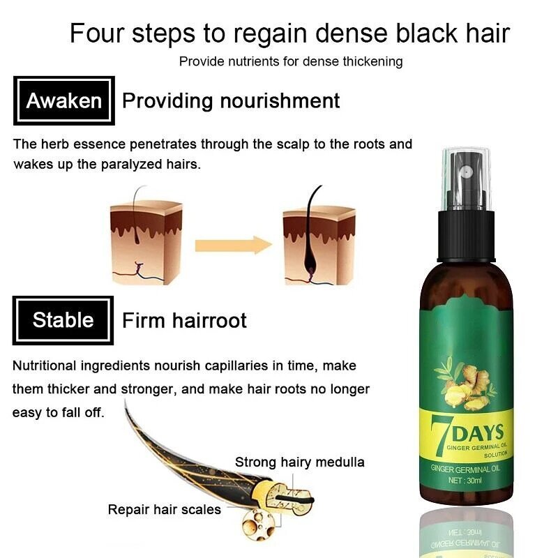Aceite en espray para el crecimiento del cabello para hombres y mujeres, aceite de jengibre para promover el crecimiento rápido del cabello, más grueso, tratamiento anticaída del cuero cabelludo, nutre el cabello, 7 días