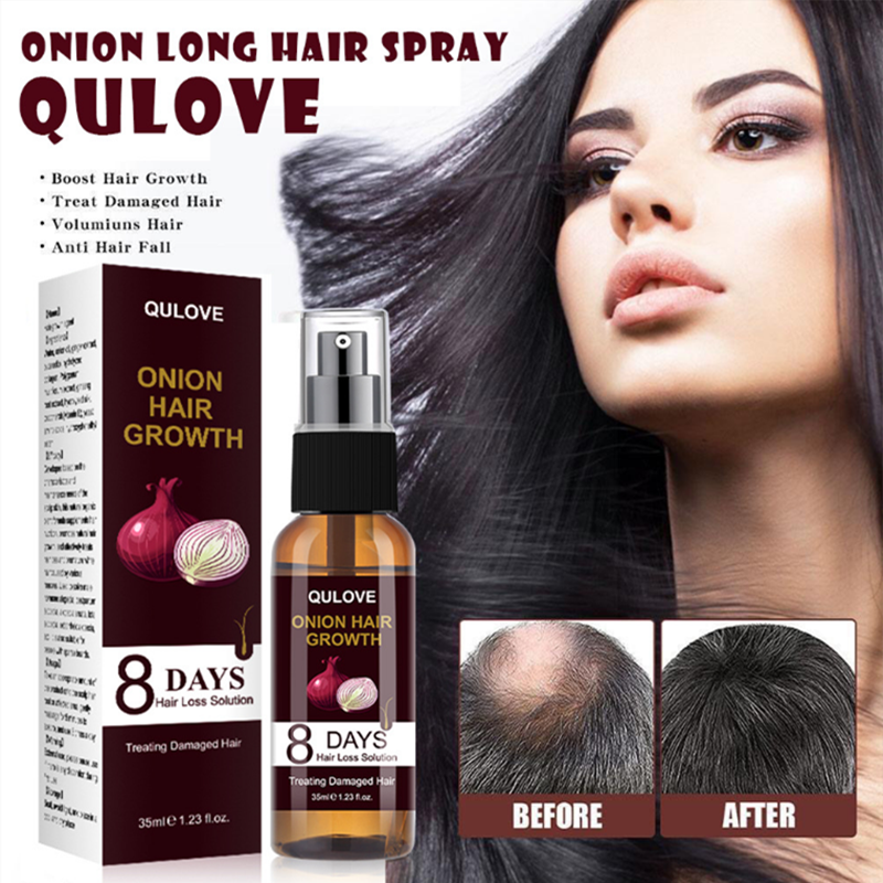 Óleo essencial de spray de cabelo de crescimento rápido, Alopecia Hair Loss Treatment, Onion Hair Growth Products for Men and Women, 35ml
