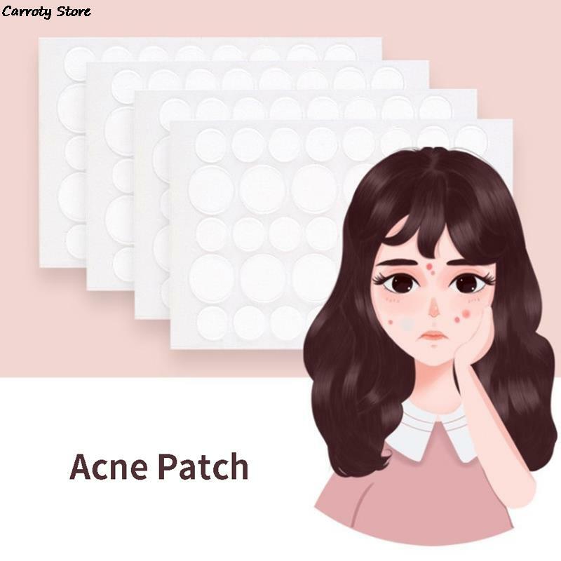 Acne Pimple Patch Adesivos, Pimple Remover Ferramenta, Absorver Pus e Óleo