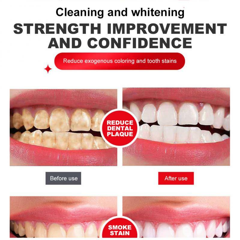 معجون أسنان تبييض بروبيوتيك SP4 ، اشراق وإزالة البقع SP4 ، نفسا جديدا ، أنزيم الأسنان ، 120g