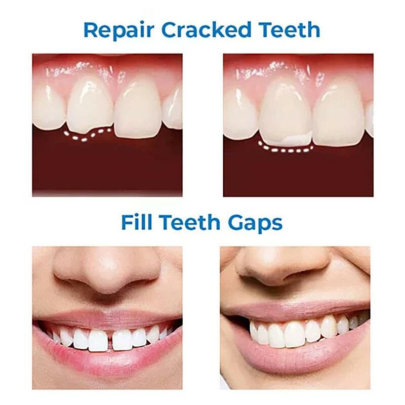 Colla per la riparazione dei denti 30ml per il fissaggio delle sostituzioni dei denti mancanti e rotti riparazione dentale dei denti finti modellabili temporanei Ki M4N8