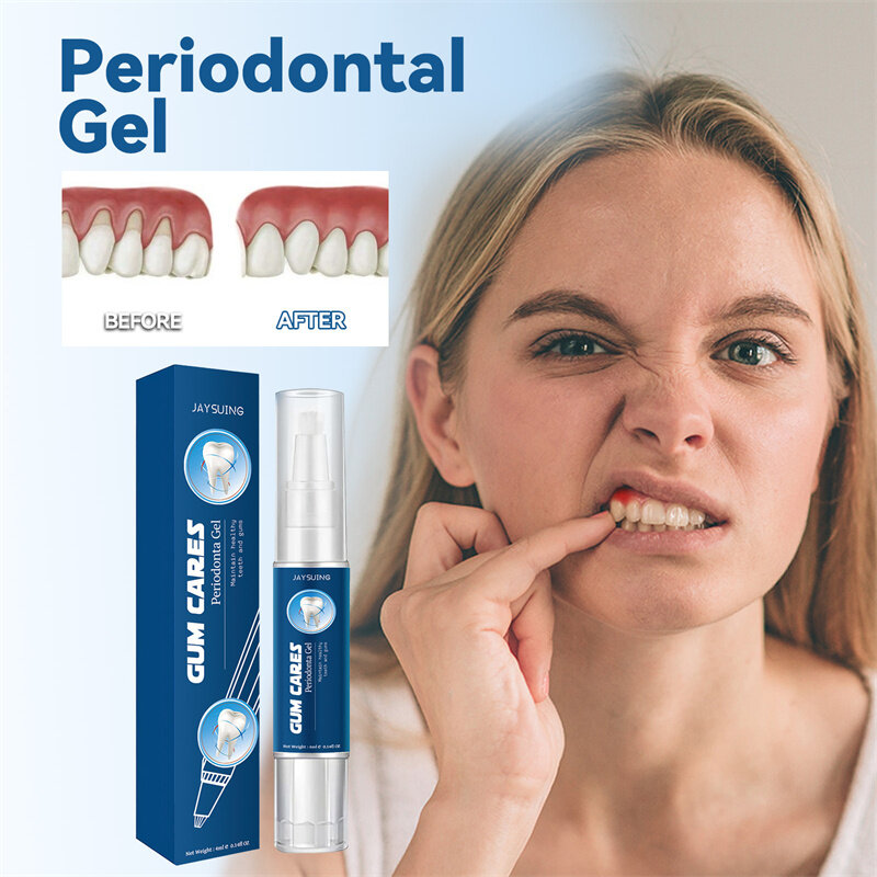 Jaysuing Gum Care Gel zur Tiefen reinigung von Zahn flecken, Zahnstein, Schwellungen und Schmerzen