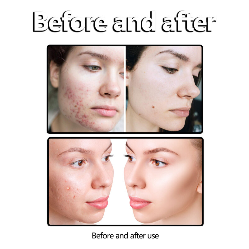 Sanfte Gesichts schaum reiniger tiefe Hautre inigung Poren Akne entfernen Flecken Öl kontrolle feuchtigkeit spendende pflegende Gesichts reinigung Hautpflege