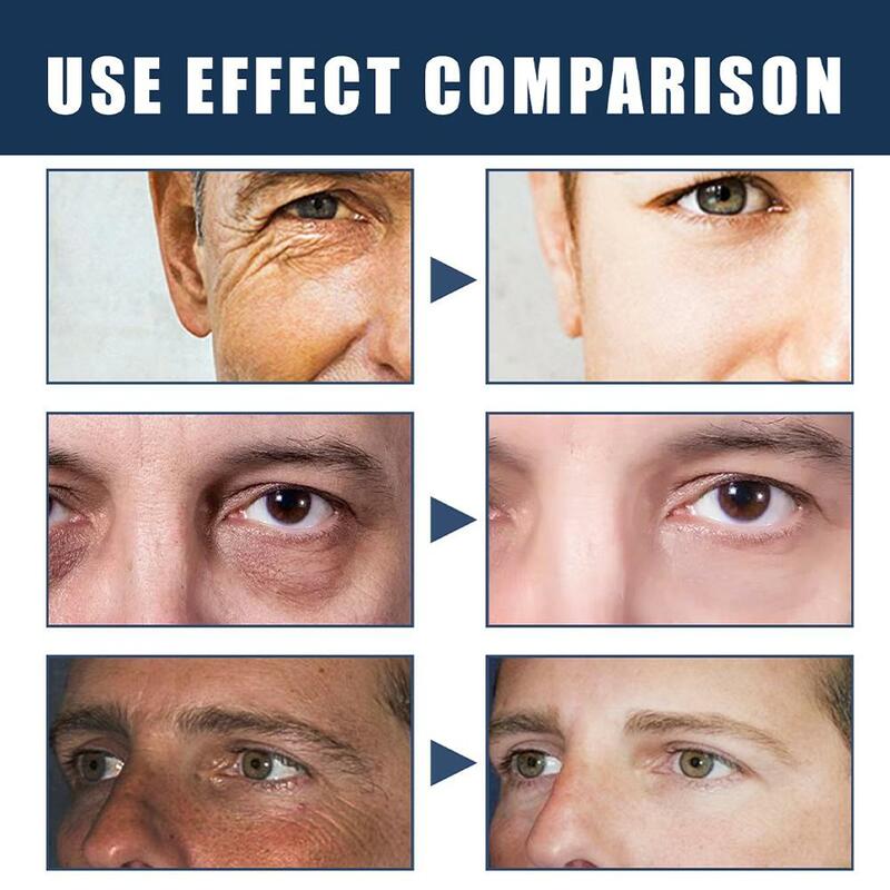 Uomini Anti-età riparazione borse per gli occhi rassodante acido ialuronico crema idratante cura del viso Drop Shipping 50ml