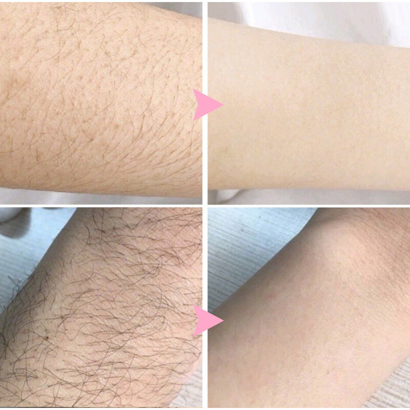 Semprotan penghilang bulu permanen pria wanita, depilator lengan ketiak tanpa rasa sakit untuk perawatan perbaikan 2 menit