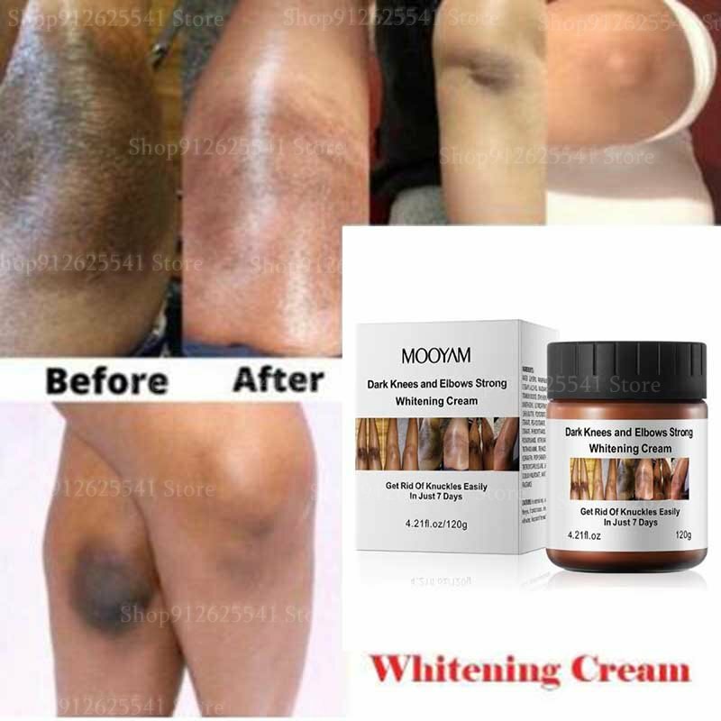 Strong Whitening ครีม Skin Lightening Serum สำหรับหัวเข่าและข้อศอก Dark Knuckles Remover ยางลบ Lightening Cream