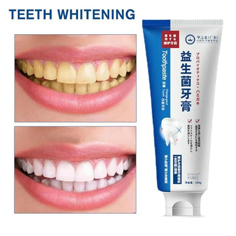 100G ซ่อมฟันผุซ่อมฟันคราบจุลินทรีย์ผุ Whitening สีเหลืองซ่อมฟันฟอกสีฟัน