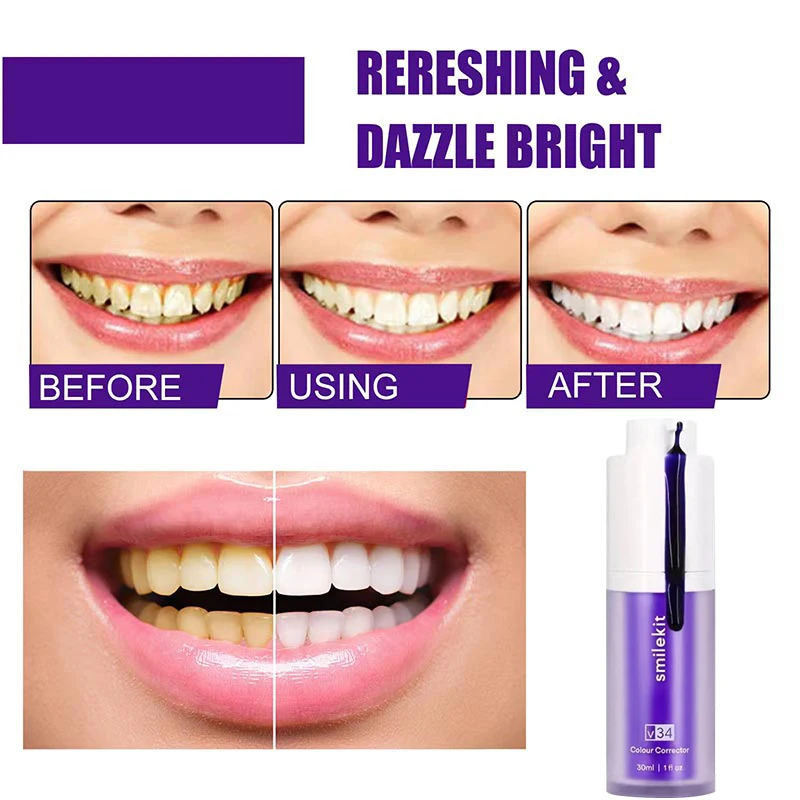 Smilekit-branqueamento dentífrico v34, reparação de dentes, branco, clareamento, cuidados dentários, roxo, reduzir amarelecimento